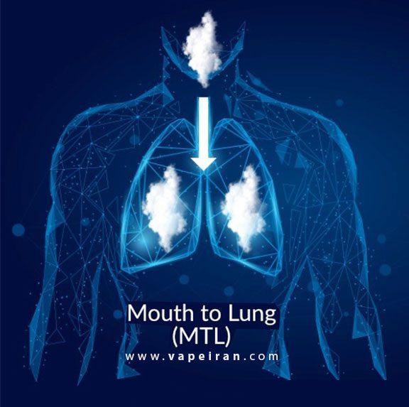 کام دهی MTL و DTL چیست